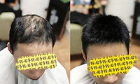 重庆各类无痕接发定制