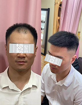 男士假发定制