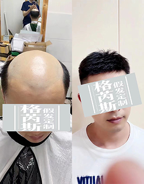 各类无痕接发定制
