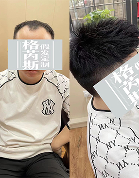 各类无痕接发定制