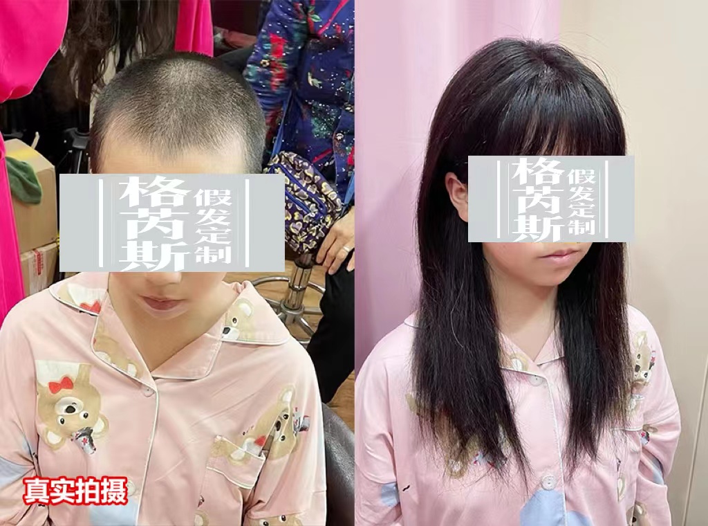 女士增发效果