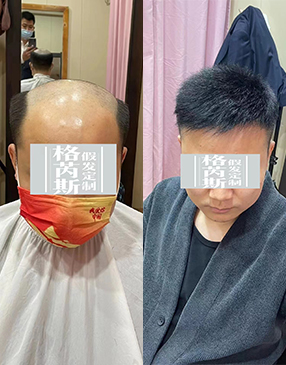 各类无痕接发定制