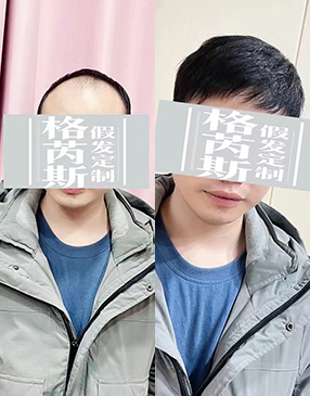 各类无痕接发定制