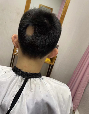 织发补发