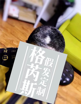 织发补发