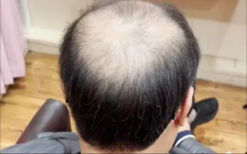 现在的假发工艺真的超乎你的想象