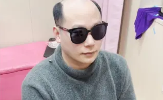 定制假发的意义在于符合自己的审美、穿搭、年龄